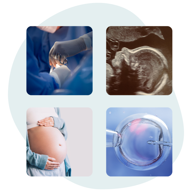 4 images illustrant, la chirurgie, une échographie, une femme enceinte et une fécondation in vitro